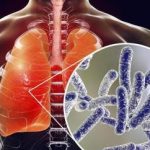 ТУБЕРКУЛЬОЗ ТА ГЕПАТИТ С: ЧОМУ ВАЖЛИВЕ ПАРАЛЕЛЬНЕ ТЕСТУВАННЯ ТУБЕРКУЛЬОЗ ТА ГЕПАТИТ С: ЧОМУ ВАЖЛИВЕ ПАРАЛЕЛЬНЕ ТЕСТУВАННЯ