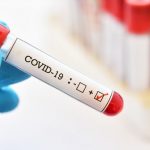 Алгоритм дій у разі отримання позитивного тесту на COVID-19 Алгоритм дій у разі отримання позитивного тесту на COVID-19
