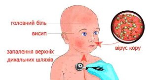 Наш заклад отримав вакцину проти кору