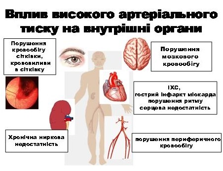 Вплив високого артеріального тиску на внутрішні органи