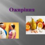 Ожиріння: причини, лікування та профілактика Ожиріння: причини, лікування та профілактика