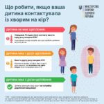 Що робити, якщо ваша дитина контактувала із хворим на кір?