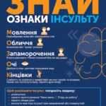 Попередь, розпізнай, врятуй: алгоритм дій при перших ознаках інсульту
