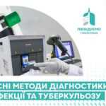 Сучасні методи діагностики ТБ-інфекції та туберкульозу